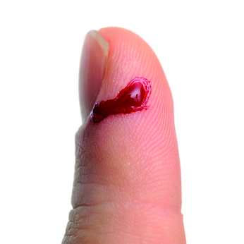 http://www.sistel.asso.fr/wp-content/uploads/2013/10/Fotolia_49391705_XS.jpg